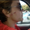 05_jill_got_bit_by_a_dog