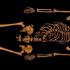 King Richard III Bones